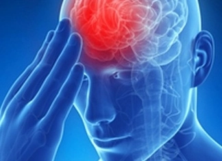 Spriječiti se može 90 posto moždanih udara