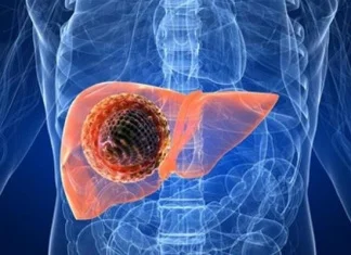 Danas je Svjetski dan hepatitisa – ova bolest ne može čekati