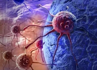 Karcinom debelog crijeva treći po učestalosti kod muškaraca i žena