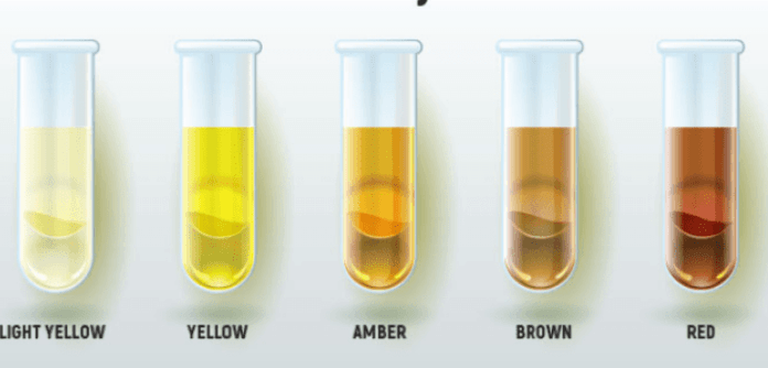 Šta boja i miris urina govore o Vašem zdravlju