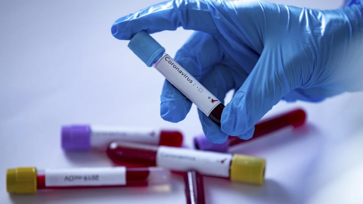 U Republici Srpskoj još 15 pozitivnih na koronavirus