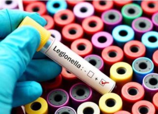 Legionella