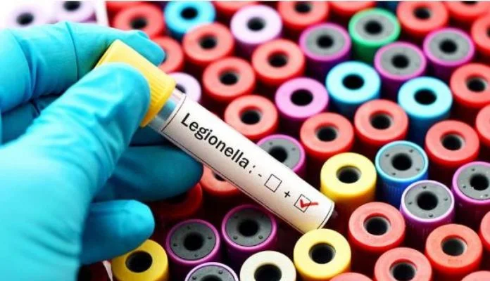 Legionella