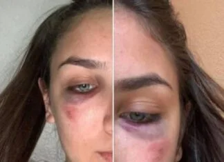 Reprezentativke BiH u karateu Ema i Ena Selman pretučene u svom stanu Ema I Ena Selman