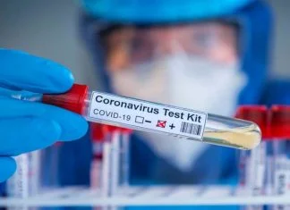 U BiH nijedna laboratorija nije akreditovana za testiranje na COVID-19