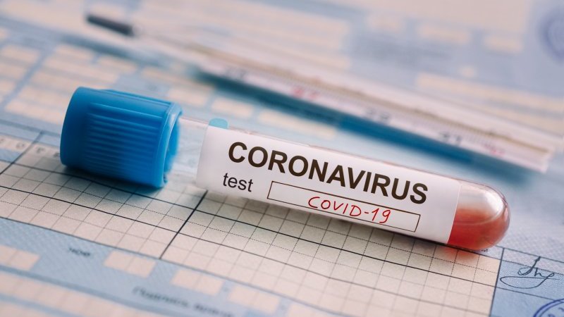 Novih 100 zaraženih koronavirusom u FBiH