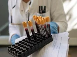 Koronavirus Test