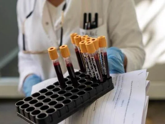 Koronavirus Test