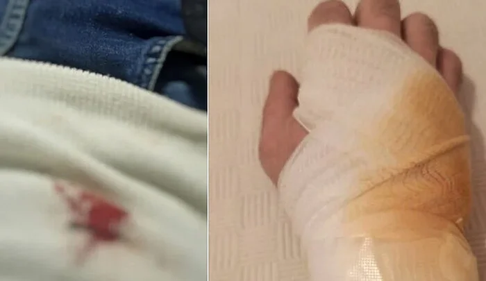 Dva migranta skalpelom napali Sarajliju na Grbavici