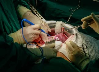 U BiH prvi put od početka pandemije transplantiran organ Operacija Srca