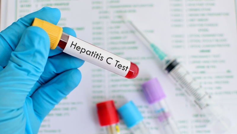 Hepatitis C Test