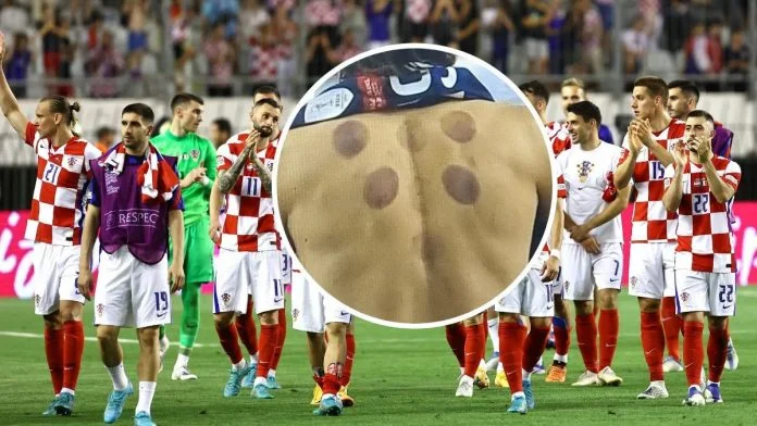 Luka Modrić Hidzama