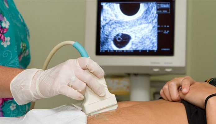 Trudnoca Ultrazvuk Abortus