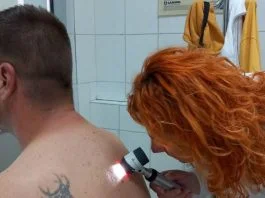 Kontrola Melanoma