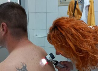 Kontrola Melanoma