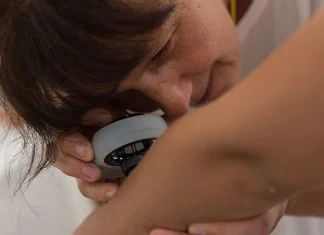 Danas besplatni dermatološki pregledi na bazenima u zeničkom naselju Crkvice Dermatoloski Pregled Dm