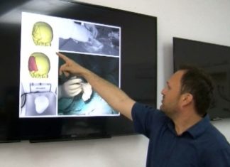 3D Modeliranje Kosti Glave