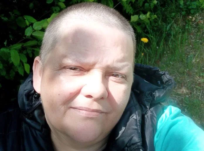 Apel za liječenje Zeničanke Arnele koja vodi bitku sa rakom Arnela Fejzić Pomozi.ba