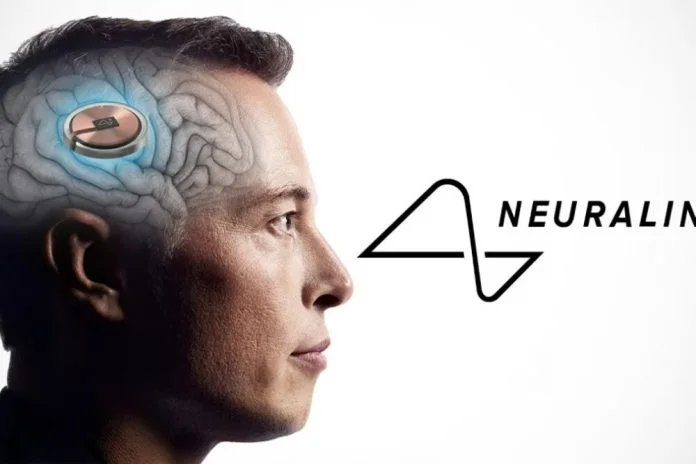 Neuralink