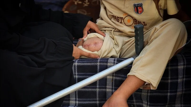 WHO: U Gazi obavljeno oko 4.050 amputacija udova