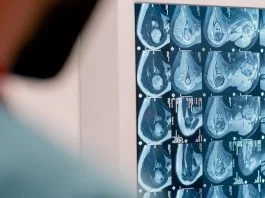 MRI Pregled Magnet