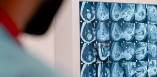 MRI Pregled Magnet
