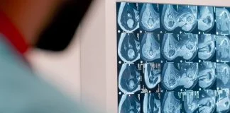 MRI Pregled Magnet