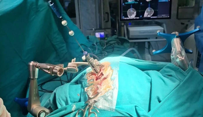 U Kantonalnoj bolnici Zenica izvedena prva iglena biopsija mozga pod kontrolom neuronavigacije