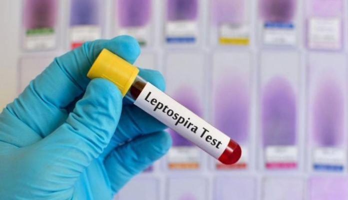 Leptospiroza
