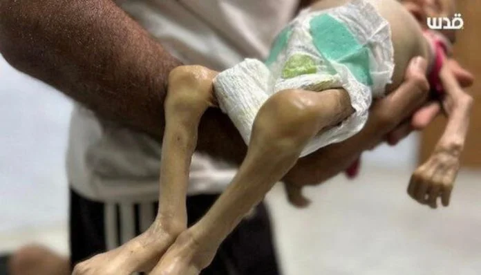 Sestomjesecna Beba Preminula Maj