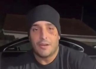 Darko Lazić doživio novu nesreću: Pao sa kvada i slomio rebro Darko Lazić