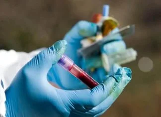 Stručni panel o zoonozama u Zenici: Jačanje saradnje za bržu i efikasniju reakciju na prijetnje po javno zdravlje